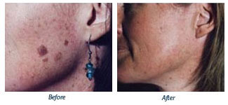 Elizabeth Miller - Before & After